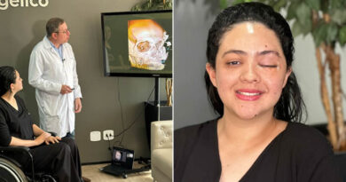 Reconstrução Facial em Londrina, no Hospital Evangélico