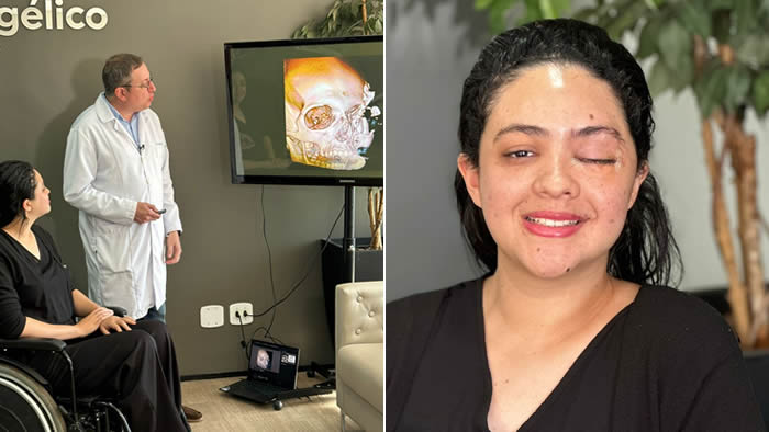 Reconstrução Facial em Londrina, no Hospital Evangélico